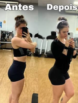 Evolução aluna - Antes e depois com aumento e definição